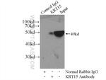 Cytokeratin 15 Antibody in Immunoprecipitation (IP)