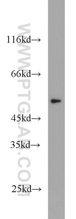 THRA Antibody in Western Blot (WB)