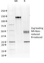 Ksp-Cadherin (Kidney-Specific Cadherin)/CDH16 Antibody in SDS-PAGE (SDS-PAGE)