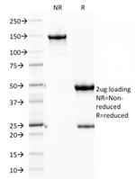 Ksp-Cadherin/CDH16 Antibody in SDS-PAGE (SDS-PAGE)