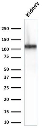 Ksp-Cadherin/CDH16 Antibody in Western Blot (WB)