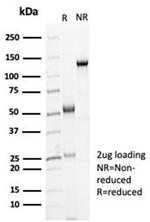 Ksp-Cadherin (Kidney-Specific Cadherin)/CDH16 Antibody in SDS-PAGE (SDS-PAGE)