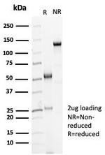 Ksp-Cadherin (Kidney-Specific Cadherin)/CDH16 Antibody in SDS-PAGE (SDS-PAGE)