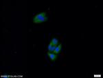 PRKAR2A Antibody in Immunocytochemistry (ICC/IF)