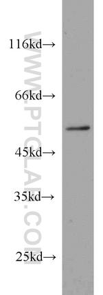 PRKAR2A Antibody in Western Blot (WB)