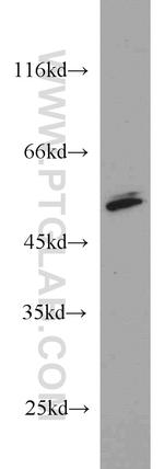 PRKAR2A Antibody in Western Blot (WB)