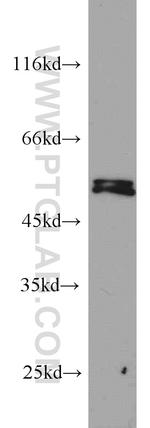 PRKAR2A Antibody in Western Blot (WB)