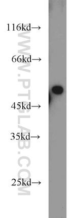 PRKAR2A Antibody in Western Blot (WB)