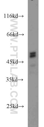 PRKAR2A Antibody in Western Blot (WB)