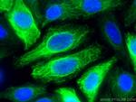 Cytokeratin 14 Antibody in Immunocytochemistry (ICC/IF)