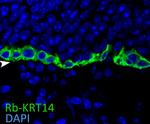 Cytokeratin 14 Antibody in Immunocytochemistry (ICC/IF)