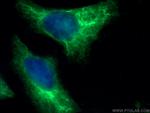 Cytokeratin 14 Antibody in Immunocytochemistry (ICC/IF)