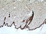 Cytokeratin 14 Antibody in Immunohistochemistry (Paraffin) (IHC (P))