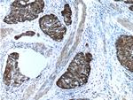 Cytokeratin 14 Antibody in Immunohistochemistry (Paraffin) (IHC (P))