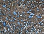 Cytokeratin 14 Antibody in Immunohistochemistry (Paraffin) (IHC (P))