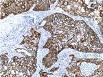 Cytokeratin 14 Antibody in Immunohistochemistry (Paraffin) (IHC (P))