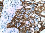 Cytokeratin 14 Antibody in Immunohistochemistry (Paraffin) (IHC (P))