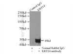 Cytokeratin 14 Antibody in Immunoprecipitation (IP)