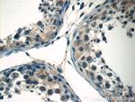 STAT1 Antibody in Immunohistochemistry (Paraffin) (IHC (P))