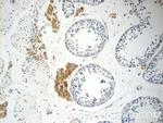 STAT1 Antibody in Immunohistochemistry (Paraffin) (IHC (P))