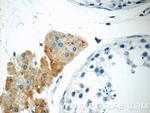 STAT1 Antibody in Immunohistochemistry (Paraffin) (IHC (P))