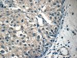 STAT1 Antibody in Immunohistochemistry (Paraffin) (IHC (P))