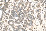 STAT1 Antibody in Immunohistochemistry (Paraffin) (IHC (P))