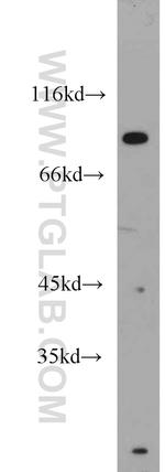 STAT1 Antibody in Western Blot (WB)