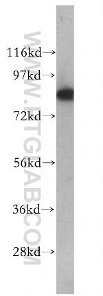 STAT1 Antibody in Western Blot (WB)