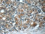 PREB Antibody in Immunohistochemistry (Paraffin) (IHC (P))