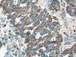 tPA Antibody in Immunohistochemistry (Paraffin) (IHC (P))