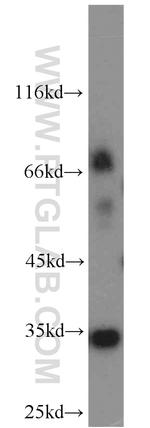 tPA Antibody in Western Blot (WB)