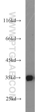 tPA Antibody in Western Blot (WB)