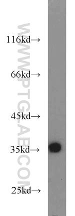 tPA Antibody in Western Blot (WB)