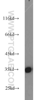 tPA Antibody in Western Blot (WB)