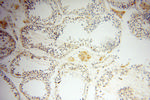 NSE Antibody in Immunohistochemistry (Paraffin) (IHC (P))