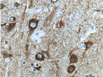 NSE Antibody in Immunohistochemistry (Paraffin) (IHC (P))