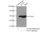 NSE Antibody in Immunoprecipitation (IP)