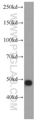 NSE Antibody in Western Blot (WB)