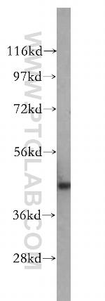 NSE Antibody in Western Blot (WB)