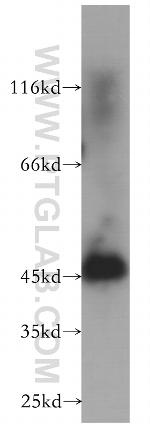 NSE Antibody in Western Blot (WB)