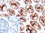 Cadherin 17/LI Cadherin (Liver-Intestine Marker) Antibody in Immunohistochemistry (Paraffin) (IHC (P))