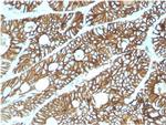 Cadherin 17/LI Cadherin Antibody in Immunohistochemistry (Paraffin) (IHC (P))