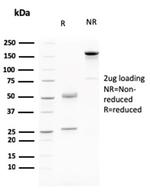 Cadherin 17/LI Cadherin Antibody in SDS-PAGE (SDS-PAGE)