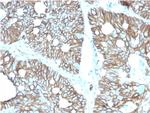 Cadherin 17/LI Cadherin (Liver-Intestine Marker) Antibody in Immunohistochemistry (Paraffin) (IHC (P))