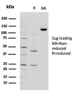 Cadherin 17/LI Cadherin (Liver-Intestine Marker) Antibody in SDS-PAGE (SDS-PAGE)