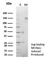 Cadherin 17/LI Cadherin (Liver-Intestine Marker) Antibody in SDS-PAGE (SDS-PAGE)