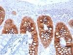 Cadherin 17/LI Cadherin (Liver-Intestine Marker) Antibody in Immunohistochemistry (Paraffin) (IHC (P))