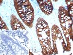 Cadherin 17/LI Cadherin (Liver-Intestine Marker) Antibody in Immunohistochemistry (Paraffin) (IHC (P))