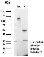 Cadherin 17/LI Cadherin (Liver-Intestine Marker) Antibody in SDS-PAGE (SDS-PAGE)